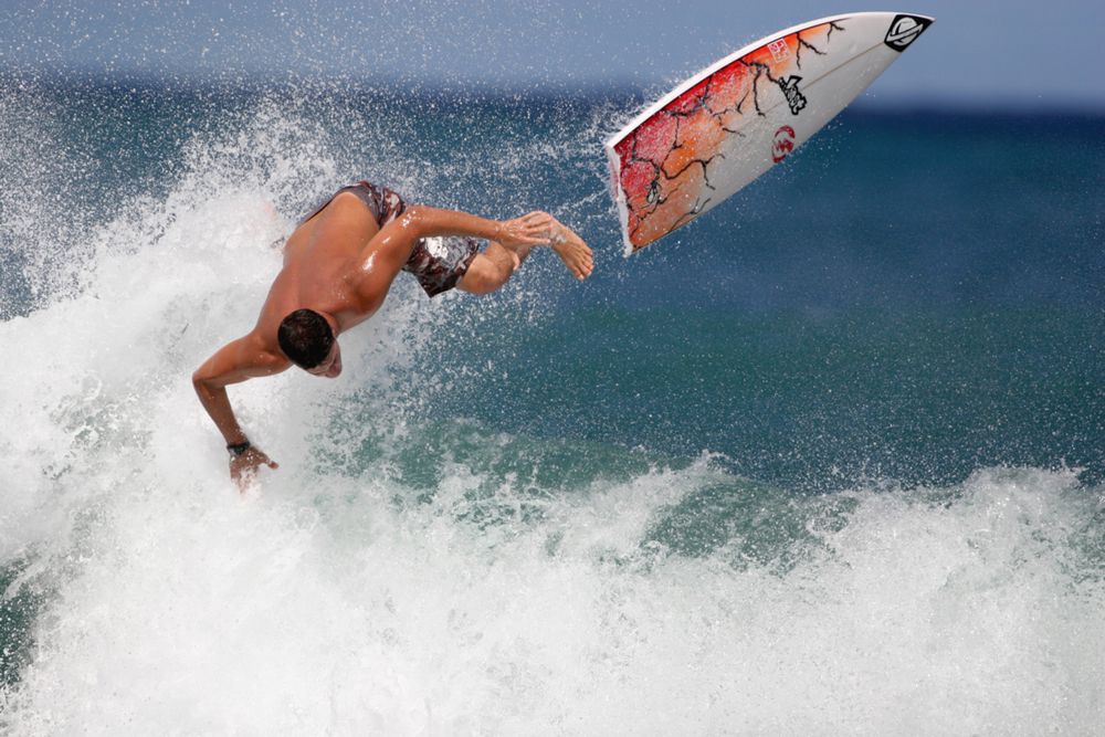 Surfing Injuries Head, Neck, and Shoulder Trauma