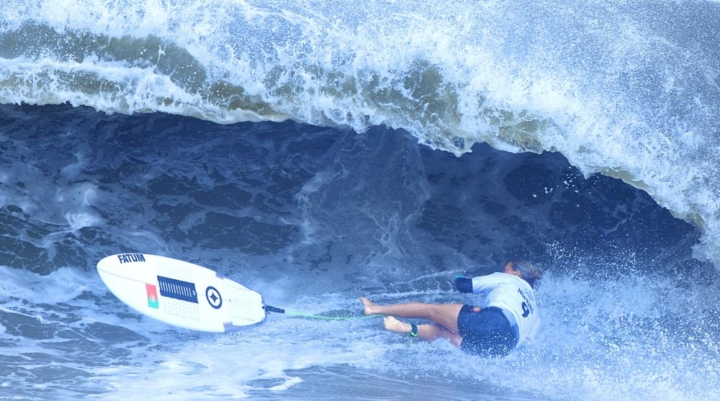 9 Most Popular Surfing Injuries and 3 Tips to Avoid Them – Boost Surfing