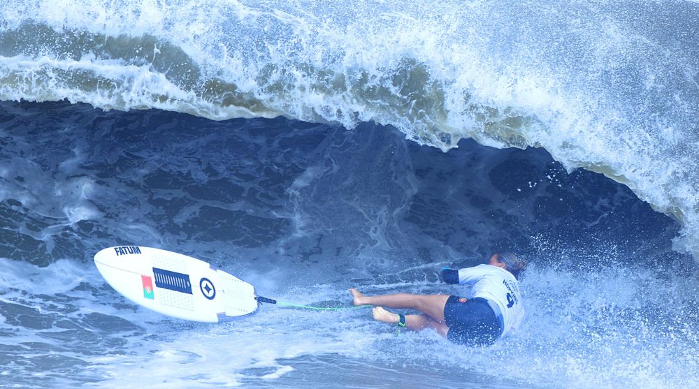 Surfing Injuries Cranial and Facial Fractures